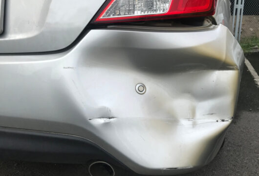 Dented fender of a car after a minor accident